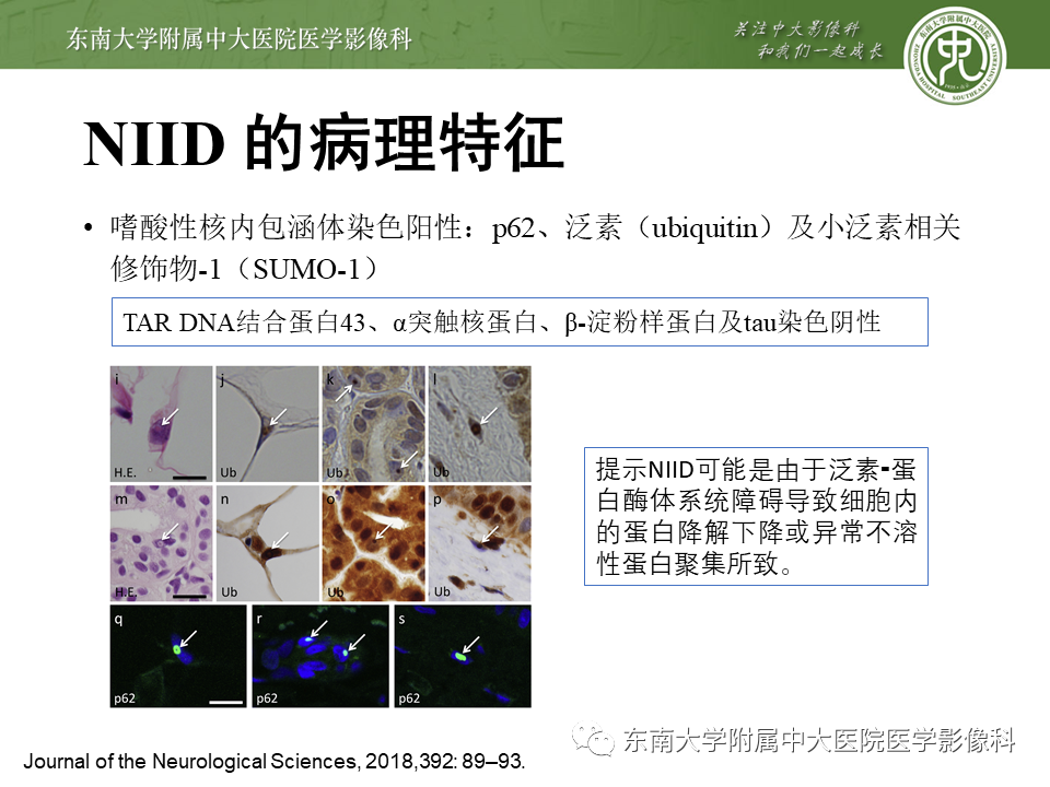 影像PPT - 【PPT】神经元核内包涵体病（NIID）的影像学诊断-9