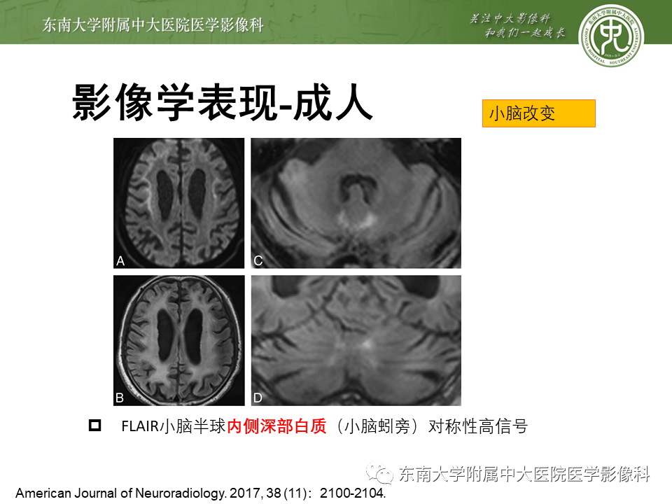 影像PPT - 【PPT】神经元核内包涵体病（NIID）的影像学诊断-22
