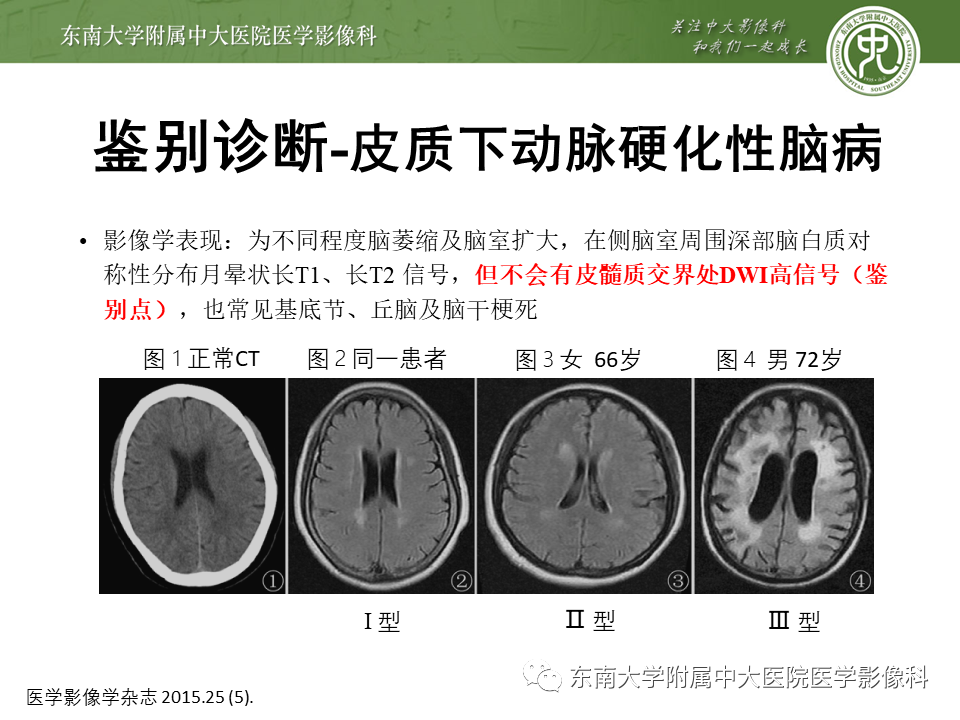 影像PPT - 【PPT】神经元核内包涵体病（NIID）的影像学诊断-31