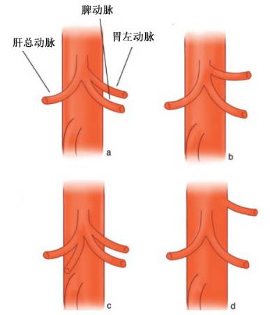 影像PPT - 腹腔干的解剖-3 影像PPT - 腹腔干的解剖-3