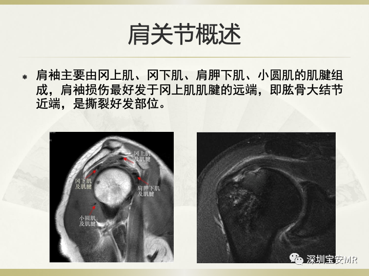 影像PPT - 【PPT】肩关节MRI检查技术-3