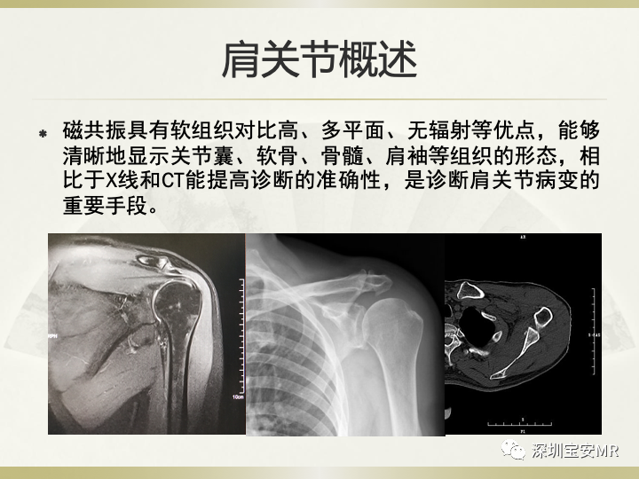 影像PPT - 【PPT】肩关节MRI检查技术-4