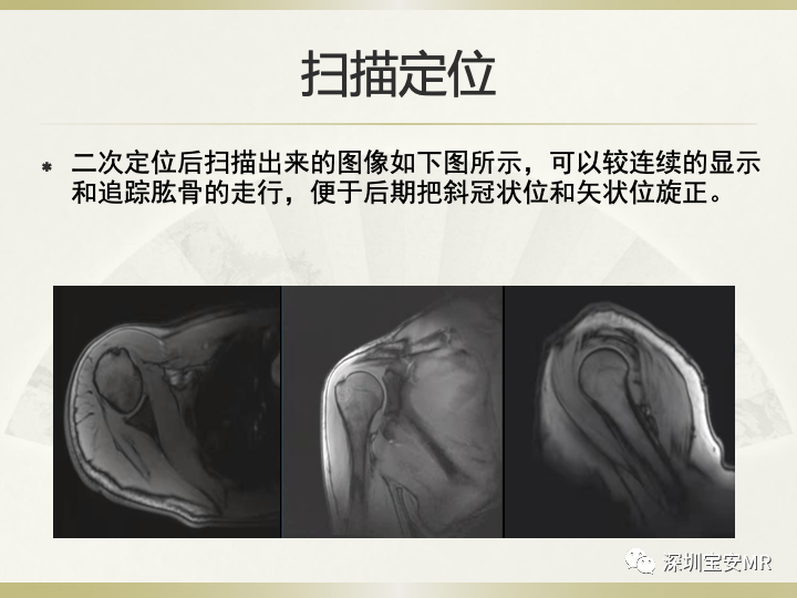 影像PPT - 【PPT】肩关节MRI检查技术-16