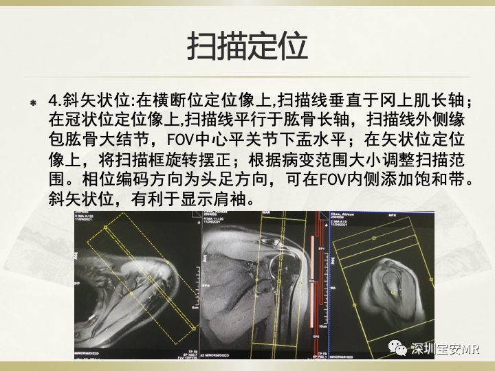 影像PPT - 【PPT】肩关节MRI检查技术-24