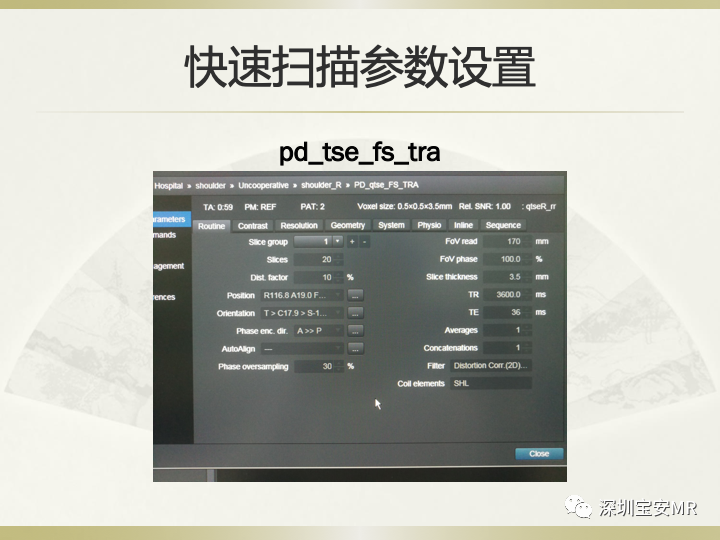 影像PPT - 【PPT】肩关节MRI检查技术-38