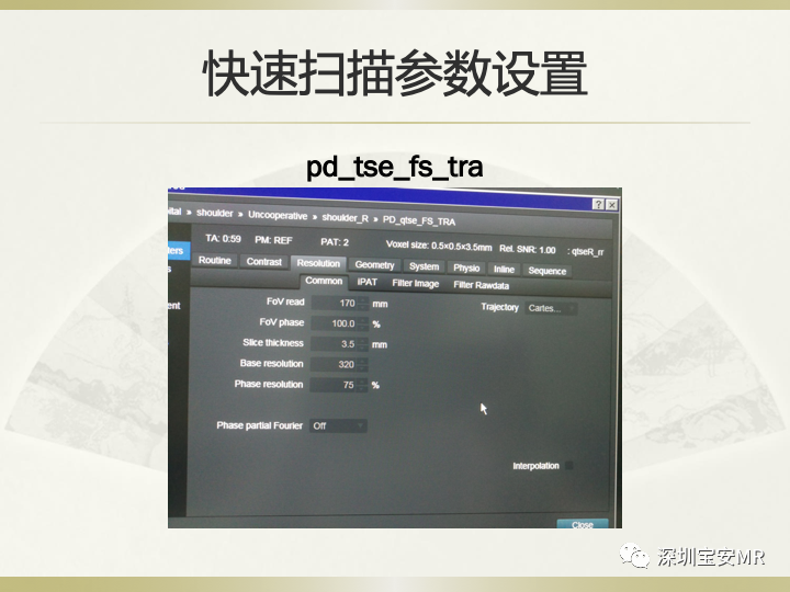 影像PPT - 【PPT】肩关节MRI检查技术-39