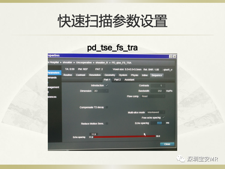 影像PPT - 【PPT】肩关节MRI检查技术-40
