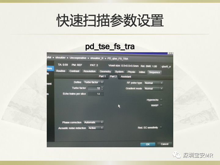 影像PPT - 【PPT】肩关节MRI检查技术-41