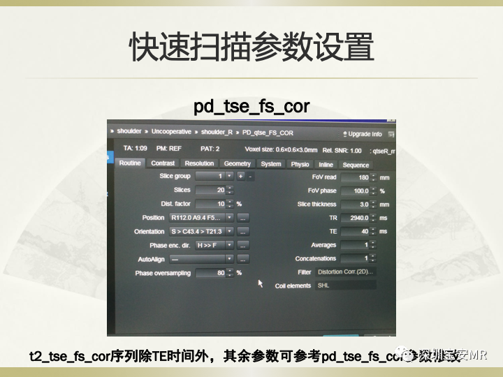 影像PPT - 【PPT】肩关节MRI检查技术-42