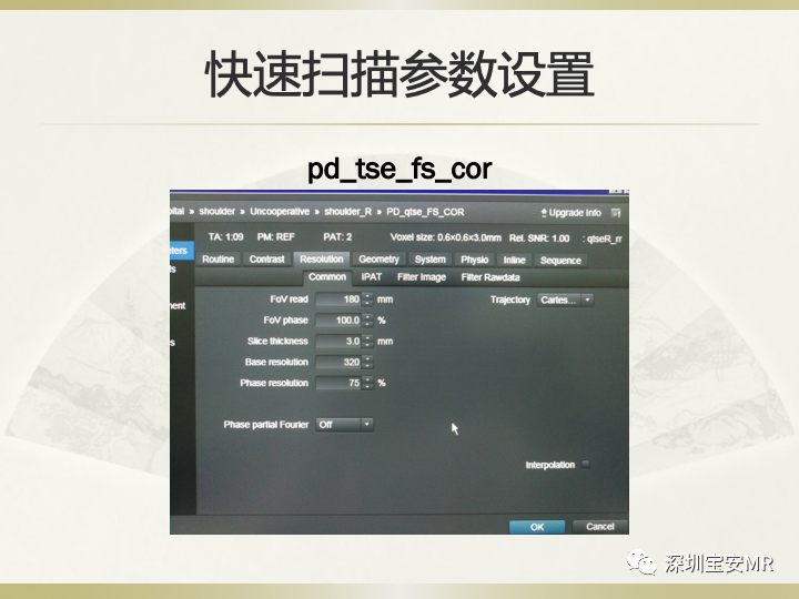 影像PPT - 【PPT】肩关节MRI检查技术-43