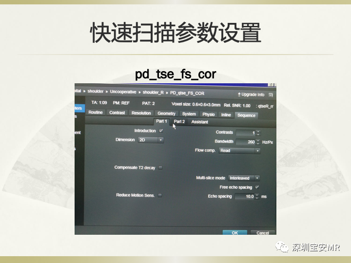 影像PPT - 【PPT】肩关节MRI检查技术-44