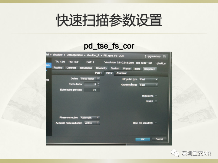 影像PPT - 【PPT】肩关节MRI检查技术-45