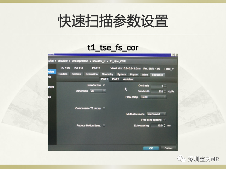 影像PPT - 【PPT】肩关节MRI检查技术-48
