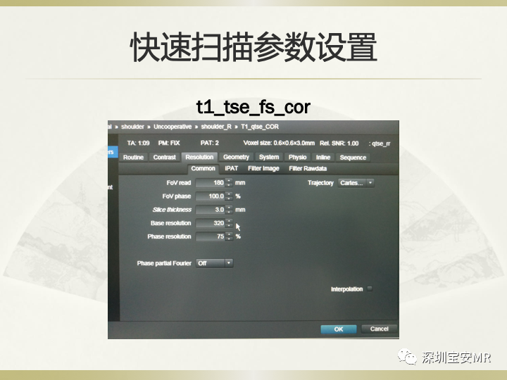 影像PPT - 【PPT】肩关节MRI检查技术-47