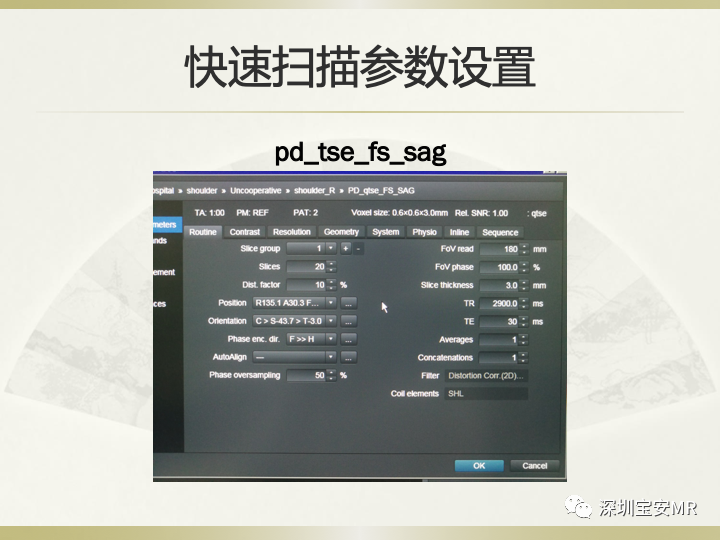 影像PPT - 【PPT】肩关节MRI检查技术-50