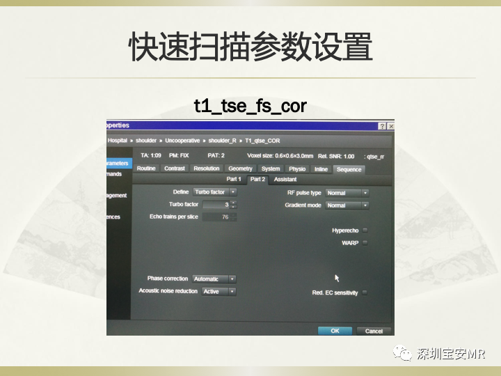 影像PPT - 【PPT】肩关节MRI检查技术-49