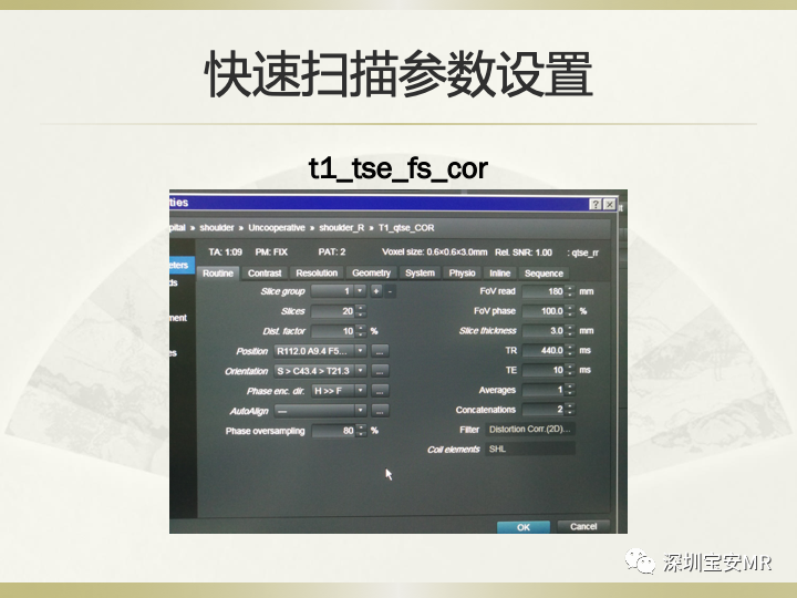 影像PPT - 【PPT】肩关节MRI检查技术-46
