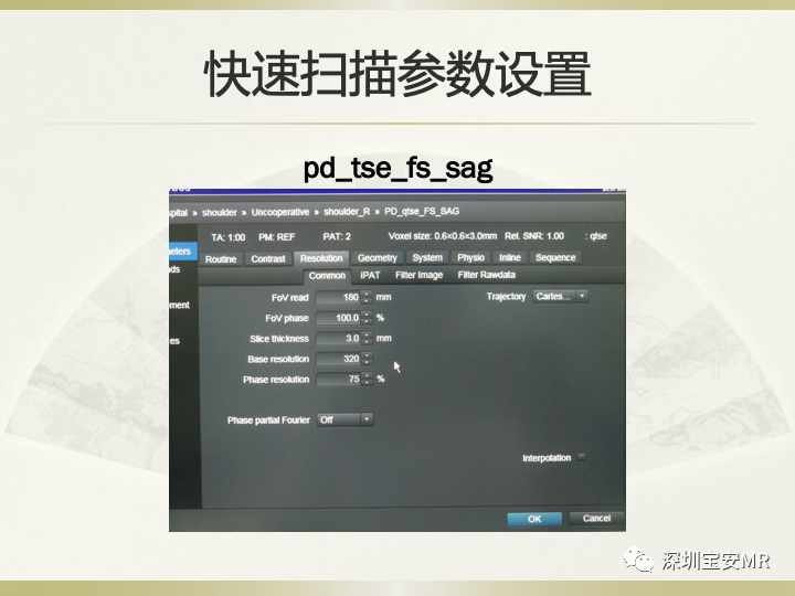 影像PPT - 【PPT】肩关节MRI检查技术-51
