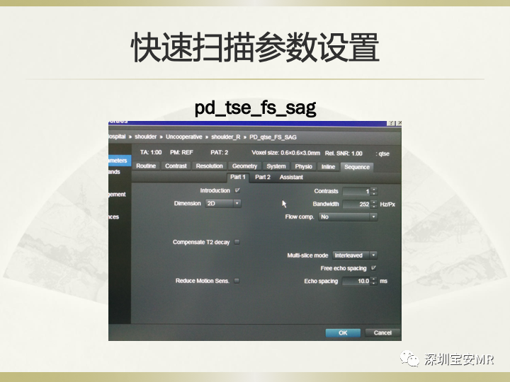 影像PPT - 【PPT】肩关节MRI检查技术-52