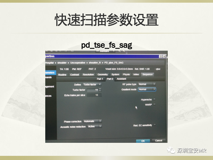 影像PPT - 【PPT】肩关节MRI检查技术-53