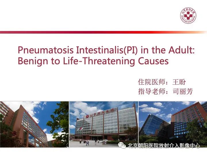 影像PPT - 【PPT】肠壁气肿/肠壁积气-12