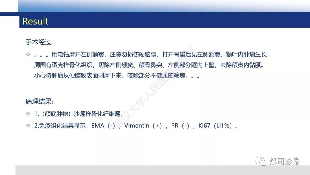 影像PPT - 【PPT】颅底沙瘤样骨化纤维瘤影像诊断-5