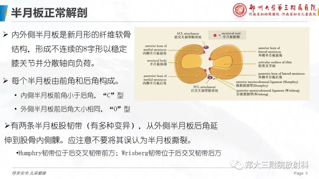 影像PPT - 【PPT】膝关节半月板病变的影像学表现-3