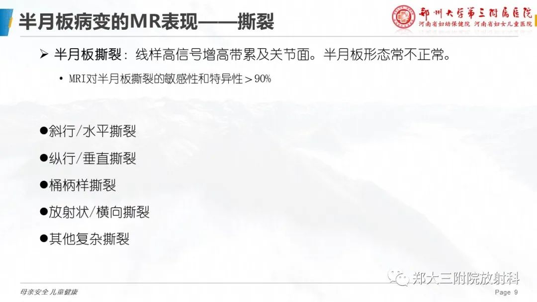 影像PPT - 【PPT】膝关节半月板病变的影像学表现-9