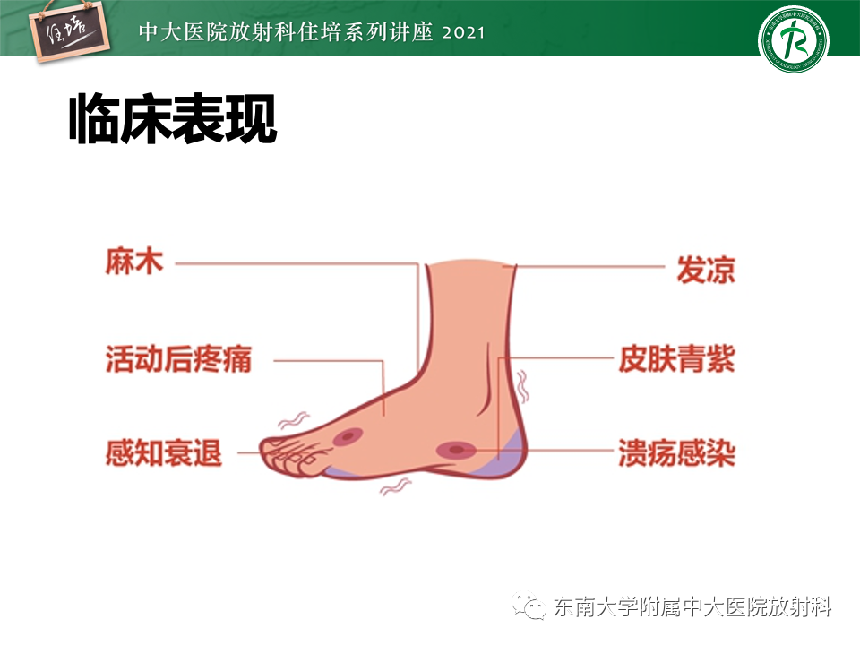 影像PPT - 【PPT】糖尿病足影像学评估-3