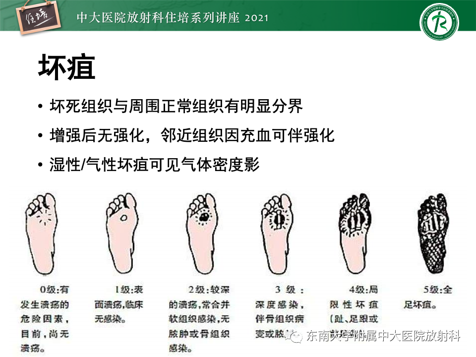 影像PPT - 【PPT】糖尿病足影像学评估-18