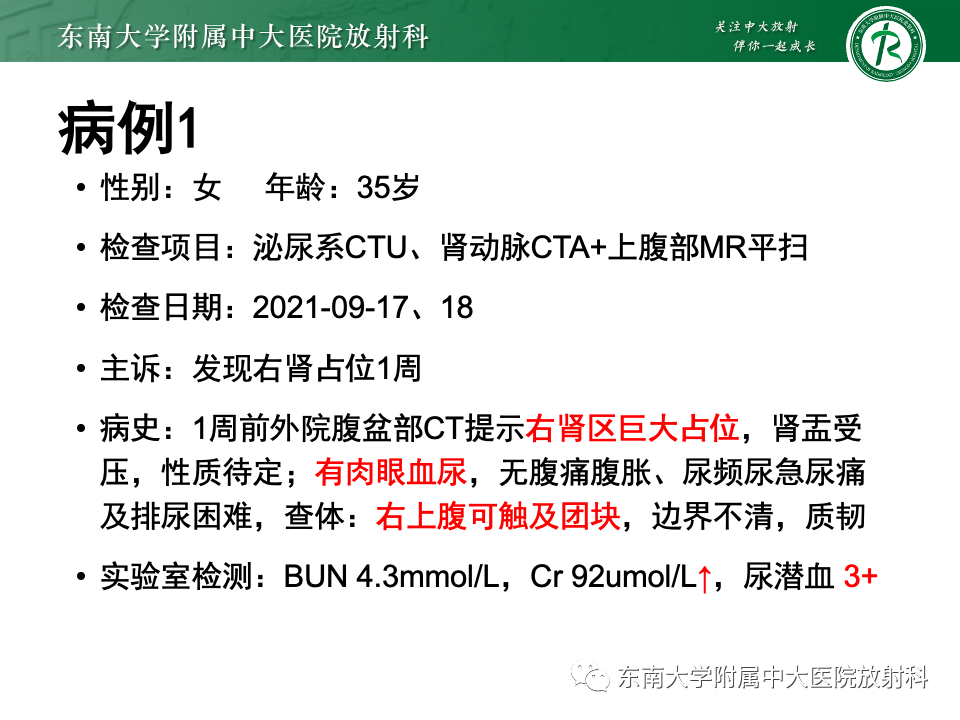 影像PPT - 【PPT】肾母细胞瘤-5