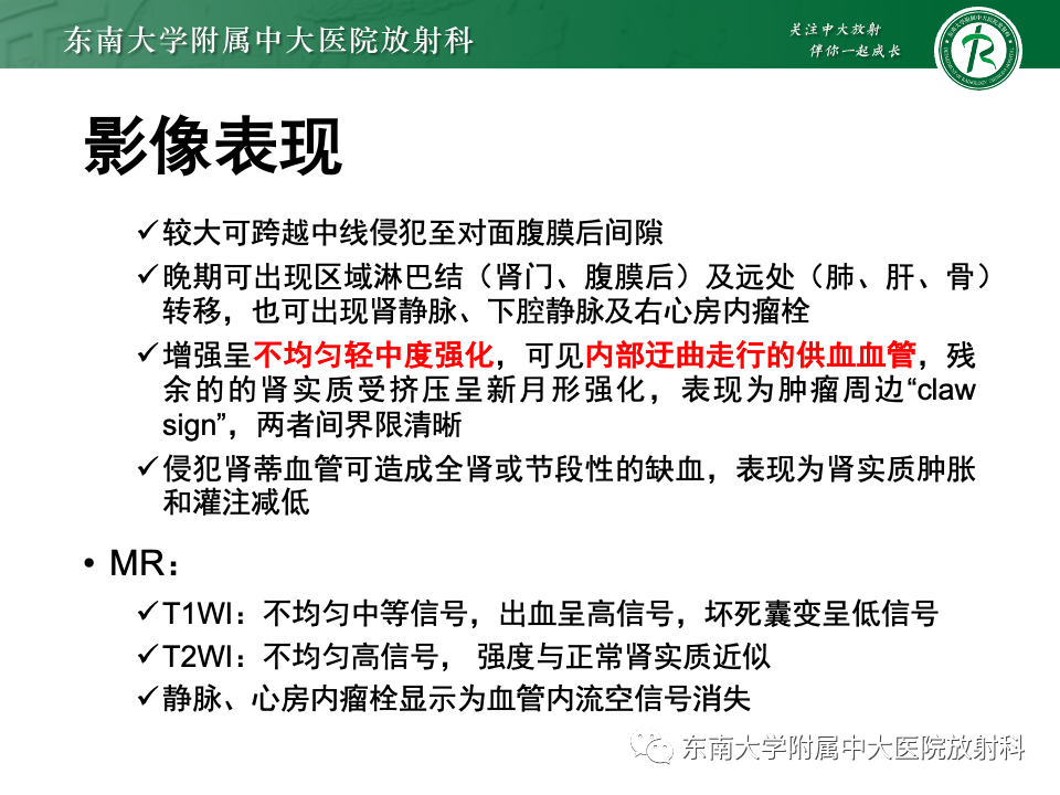 影像PPT - 【PPT】肾母细胞瘤-23