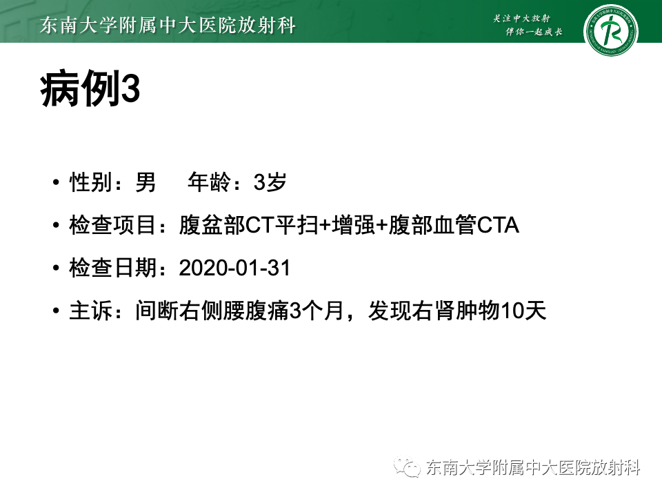 影像PPT - 【PPT】肾母细胞瘤-34