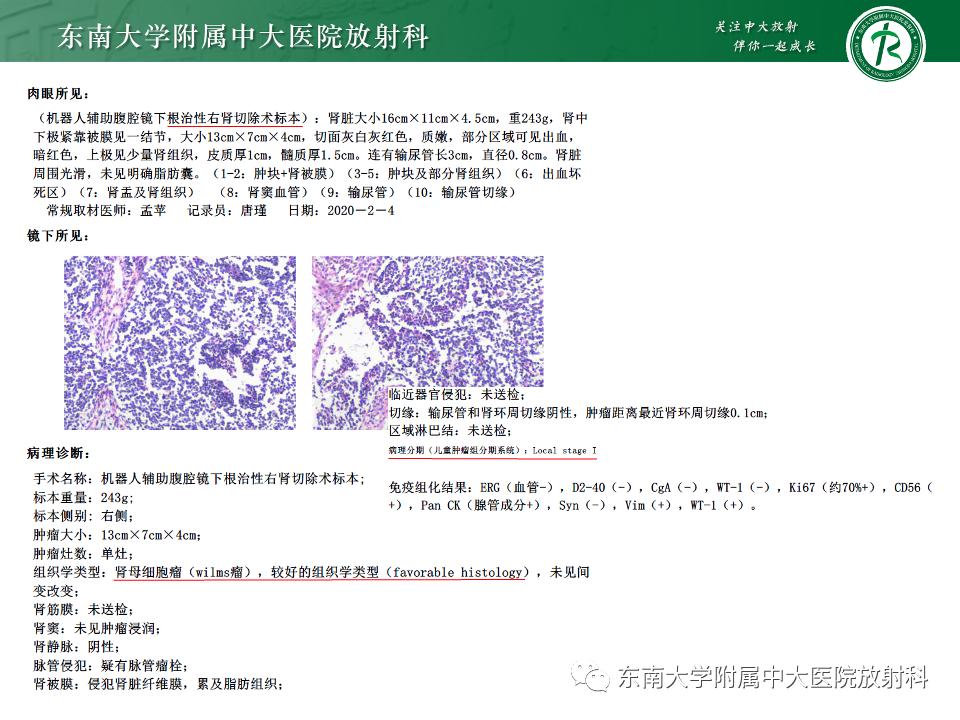 影像PPT - 【PPT】肾母细胞瘤-37