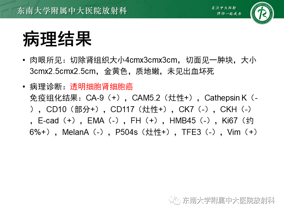 影像PPT - 【PPT】Xp11.2易位/TFE3基因融合相关性肾癌-20