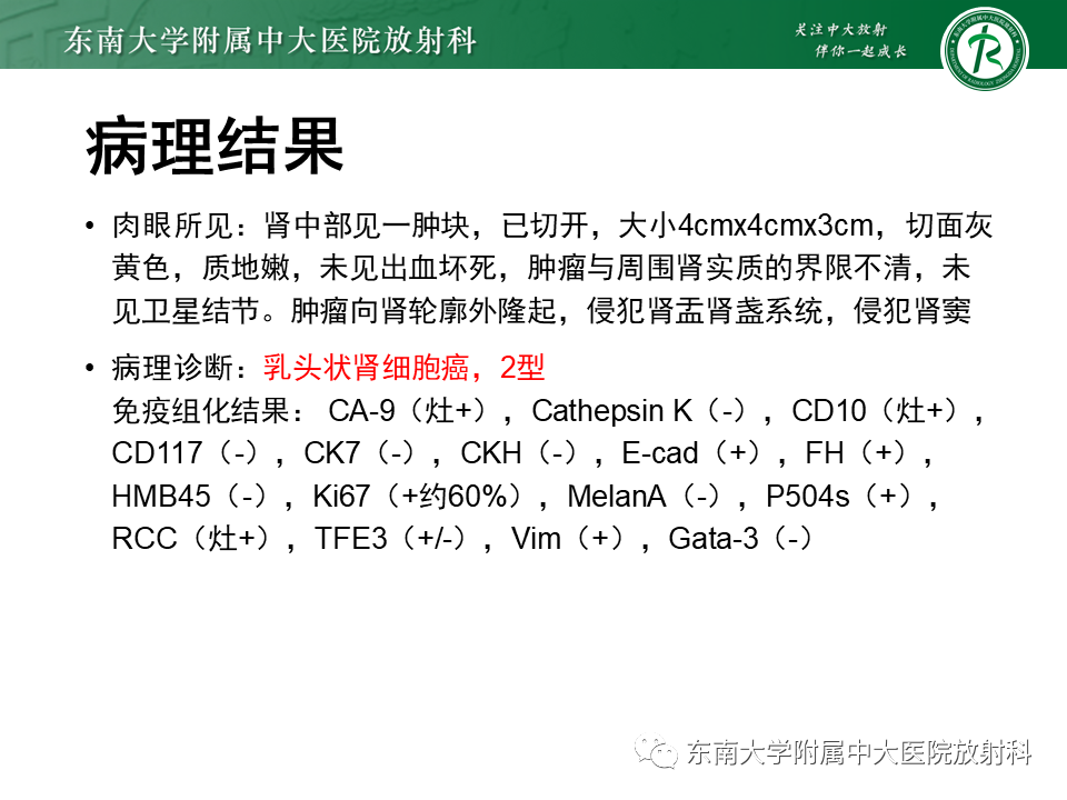 影像PPT - 【PPT】Xp11.2易位/TFE3基因融合相关性肾癌-24