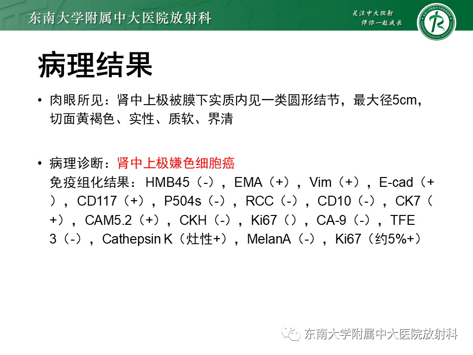 影像PPT - 【PPT】Xp11.2易位/TFE3基因融合相关性肾癌-28