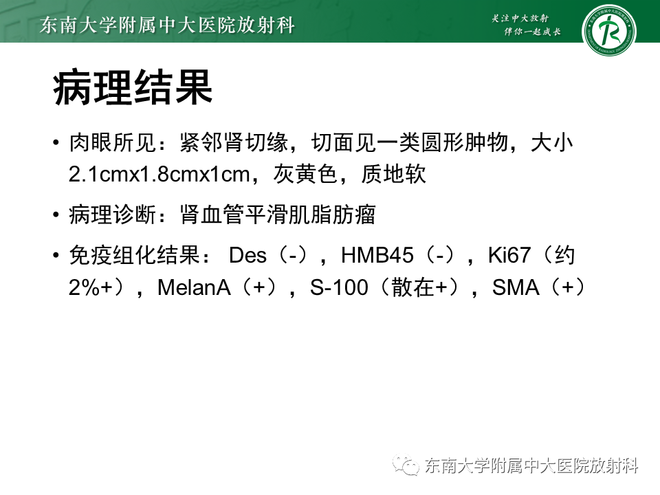 影像PPT - 【PPT】Xp11.2易位/TFE3基因融合相关性肾癌-38