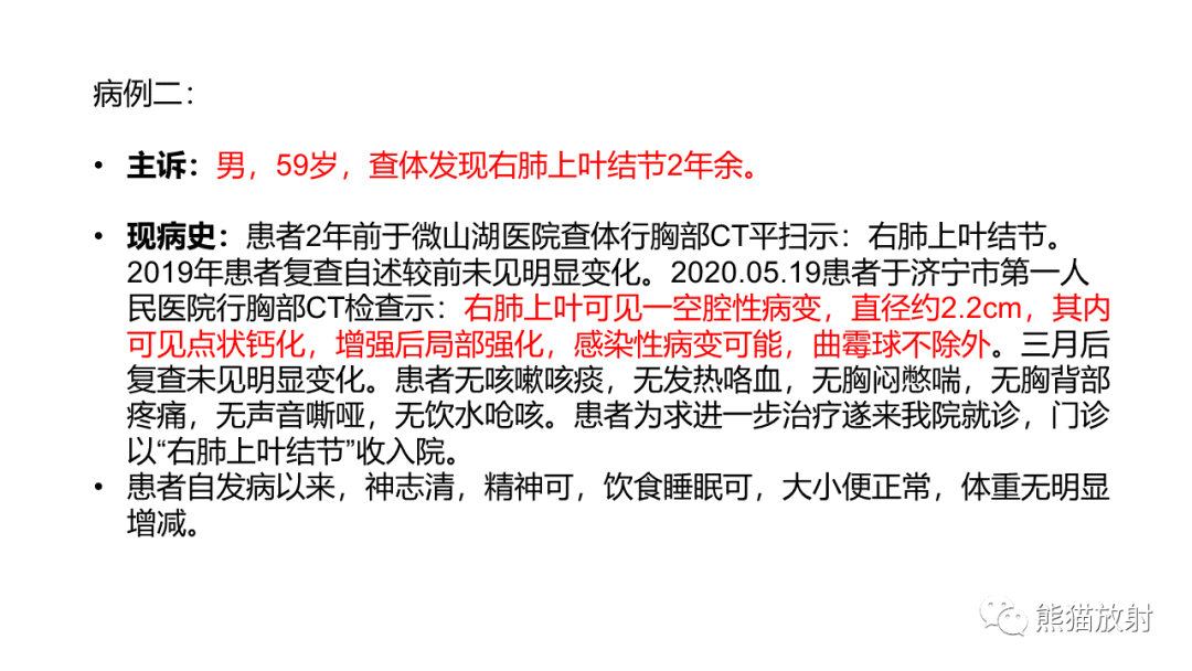 影像PPT - 【病例】支气管源性囊肿2例CT影像-14