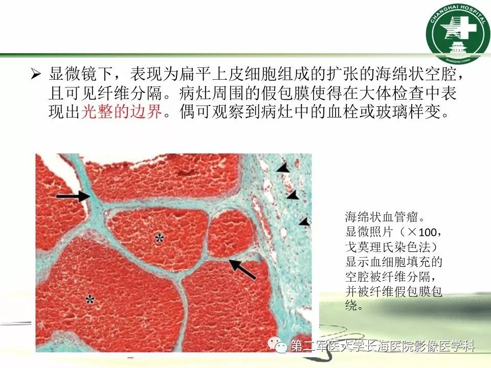 影像PPT - 【PPT】成人眼眶肿瘤：临床、影像、病理表现-11