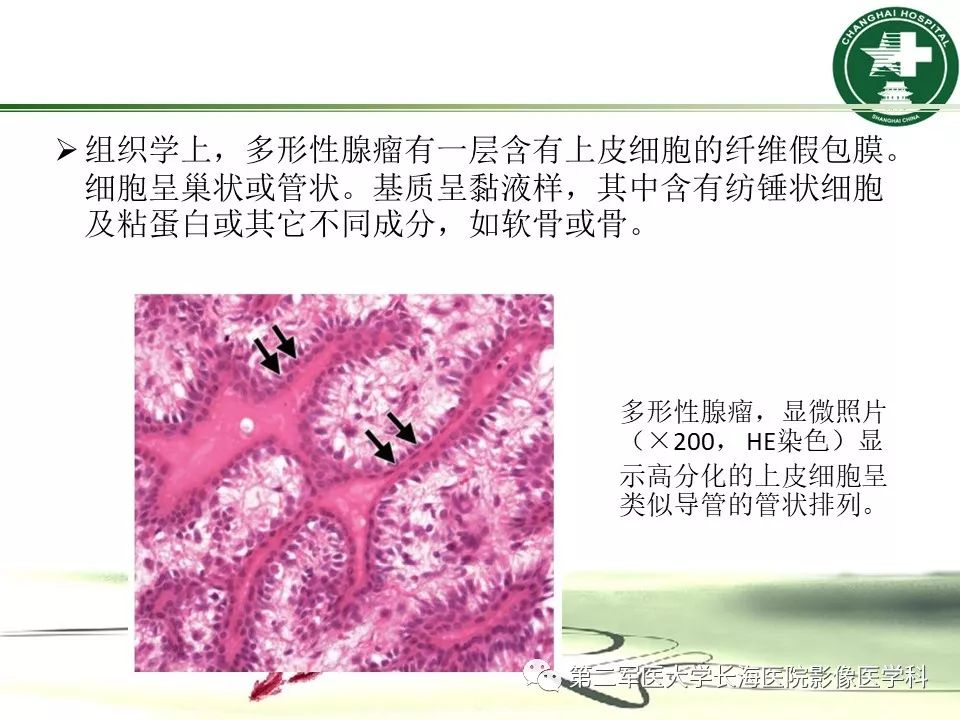 影像PPT - 【PPT】成人眼眶肿瘤：临床、影像、病理表现-24