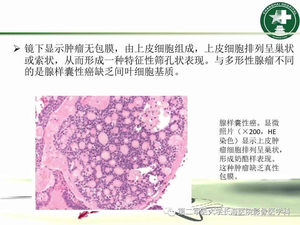 影像PPT - 【PPT】成人眼眶肿瘤：临床、影像、病理表现-29