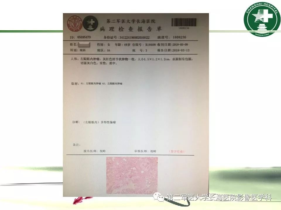 影像PPT - 【PPT】成人眼眶肿瘤：临床、影像、病理表现-61