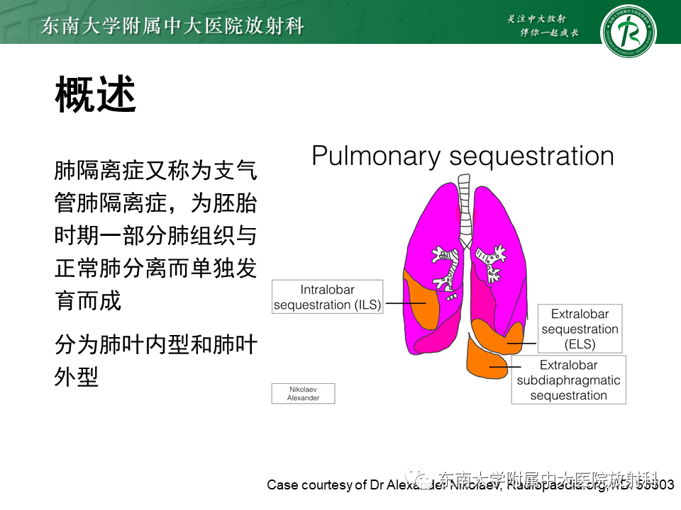 影像PPT - 【PPT】肺隔离症-4