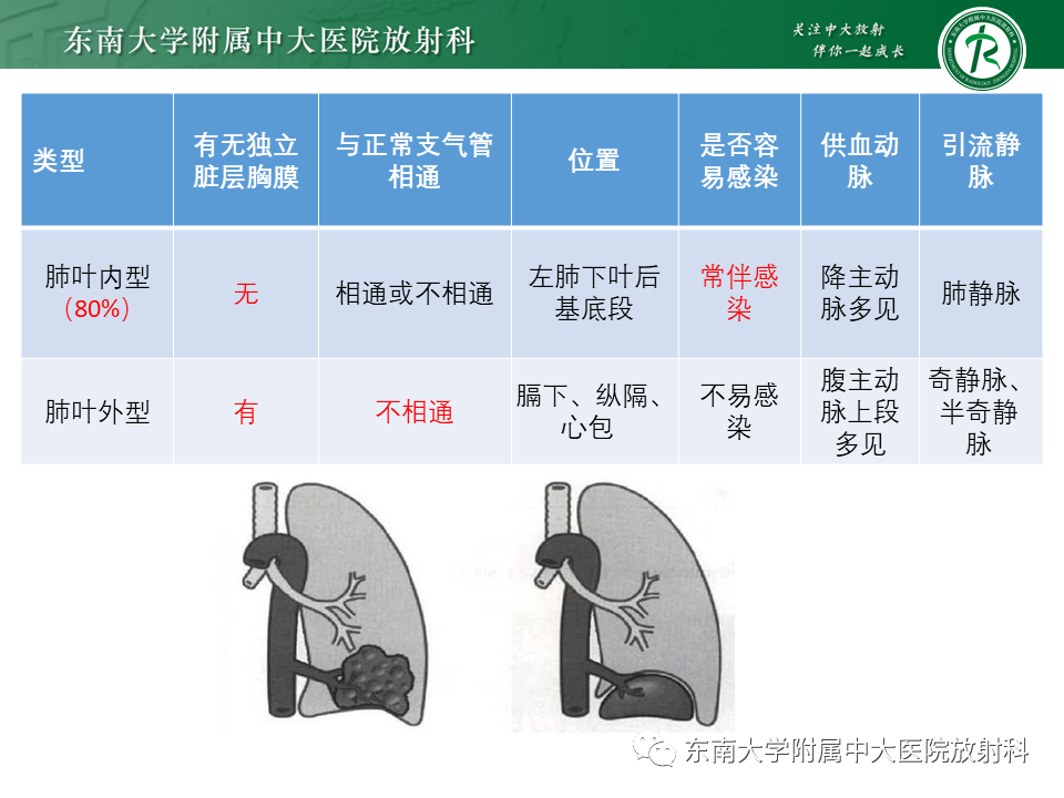 影像PPT - 【PPT】肺隔离症-9