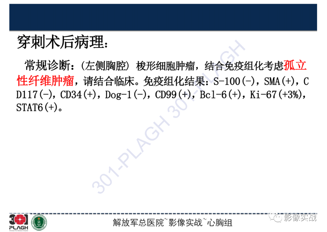 影像PPT - 【病例】左侧胸腔孤立性纤维肿瘤1例CT-19