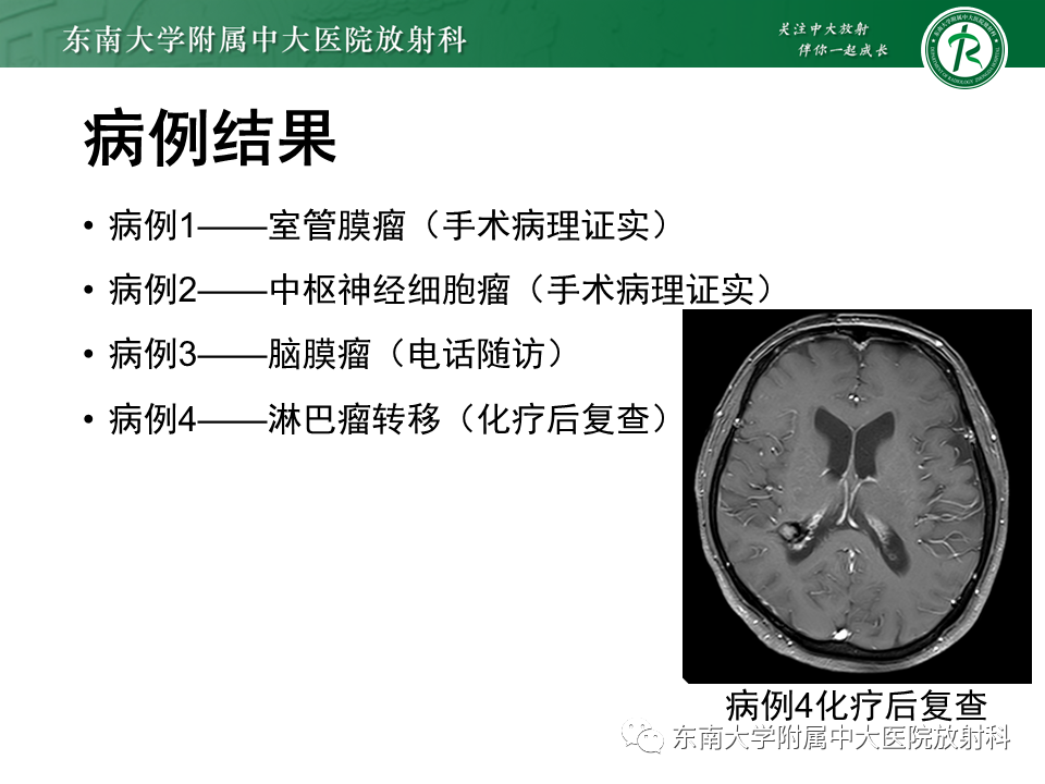 影像PPT - 【PPT】常见侧脑室占位影像诊断-1 影像PPT - 【PPT】常见侧脑室占位影像诊断-1