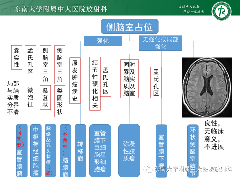 影像PPT - 【PPT】常见侧脑室占位影像诊断-27 影像PPT - 【PPT】常见侧脑室占位影像诊断-27