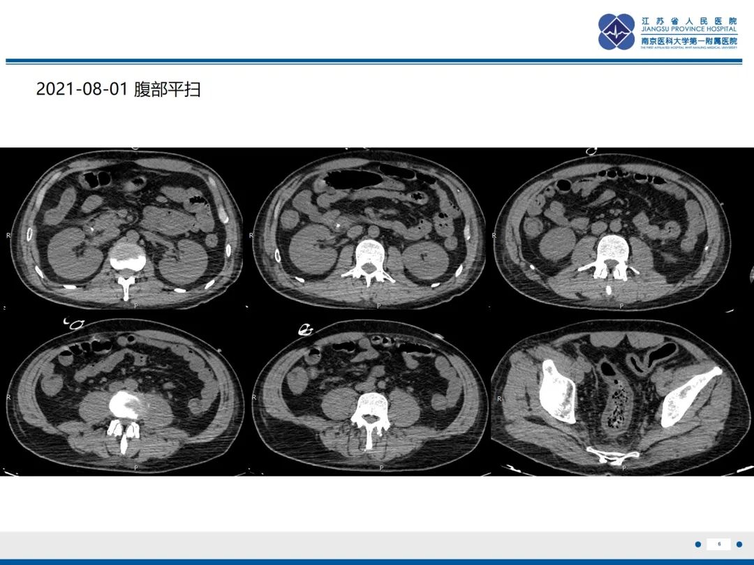 影像PPT - 【PPT】休克肠-6