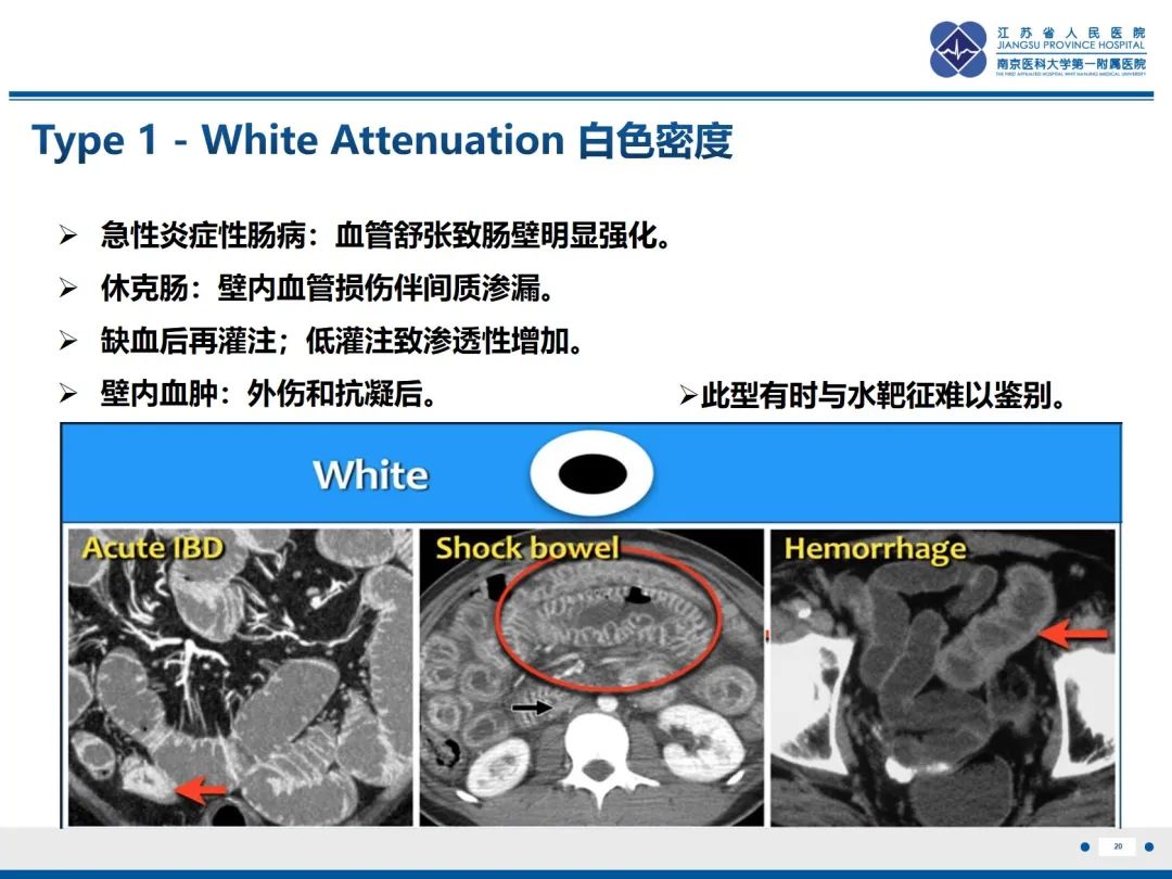 影像PPT - 【PPT】休克肠-20